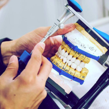 The Evolution of Dental Lab Services: How JSB Dental Lab Stands Out