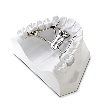 Anterior-Expansion