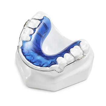 Wraparound-retainer