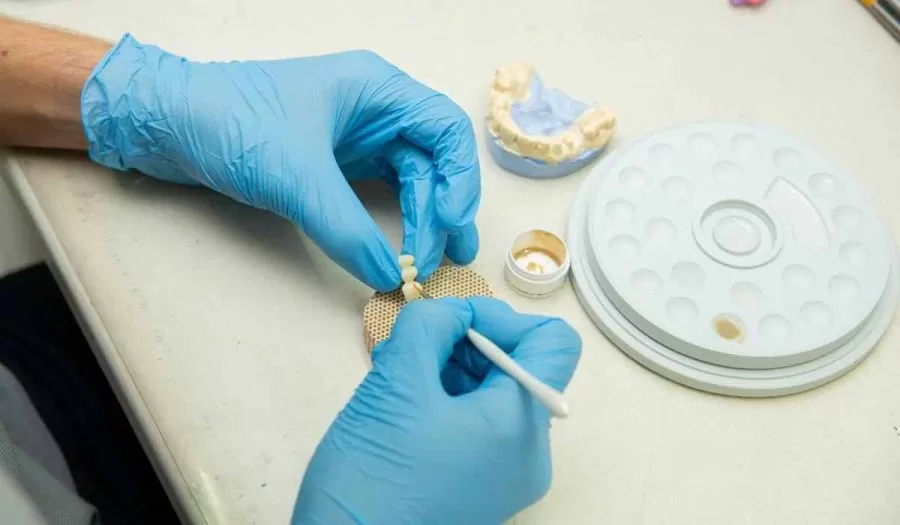 A realistic 3D render of titanium dental implants in the jawbone. | JSB Dental Lab