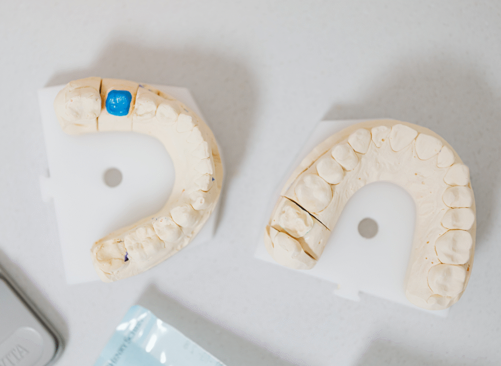An infographic explaining denture fitting and design. | JSB Dental Lab