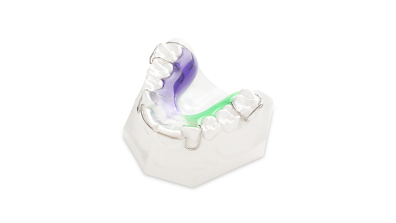 An orthodontic model block with braces fitted on teeth. | JSB Dental Lab